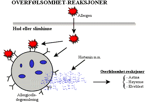 allergi